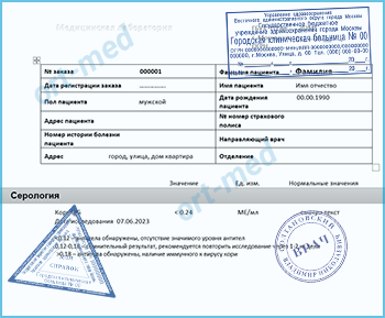 Купить тест на антитела к вирусу кори Купить справку тест на антитела к вирусу кори в Королёве официально